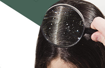 Shampoo anticaspa: como escolher e usar este produto?