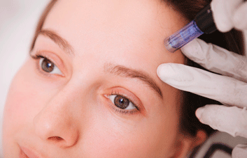 Microagulhamento facial: Conheça os benefícios e para que serve