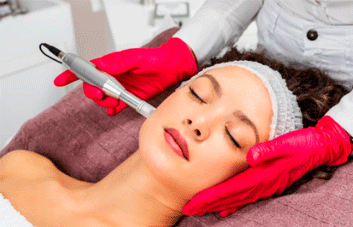 O que é o Microagulhamento? Esclareça 4 grandes dúvidas